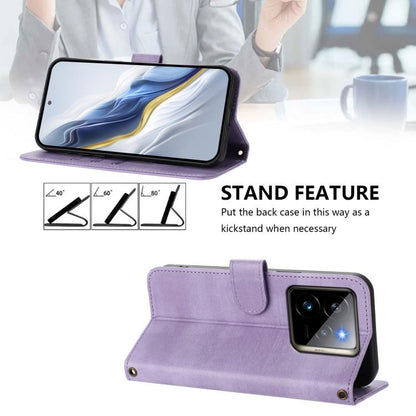 EDA007876928G_2.jpg@3cceed8119861041988260b0fc7b5bab